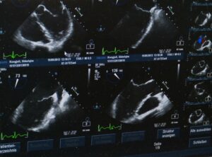 Ultraschall Bild